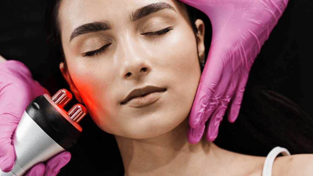 Radio Frequency for face lifting